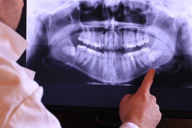 Best Broken Tooth Emergency  in Goliad, TX